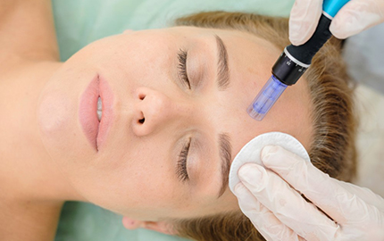 Microneedling Microneedling