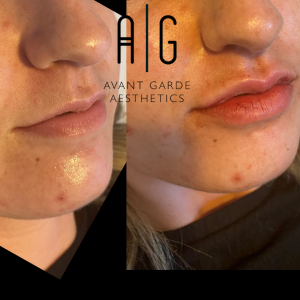 Untitled Design 1.png