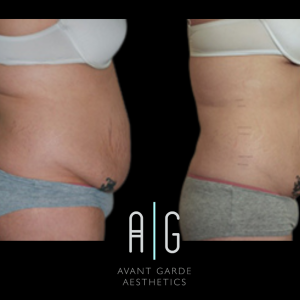 Untitled Design 13.png