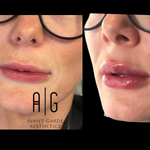 Untitled Design 2.png