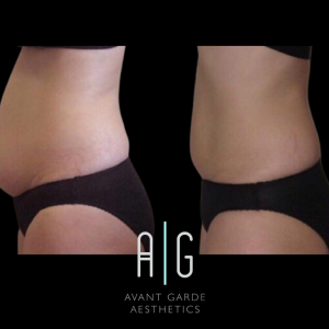 Untitled Design 6.png