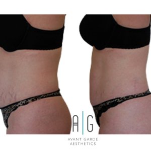 Untitled Design 9.png